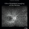 Ultra Widefield Imaging of the Retina