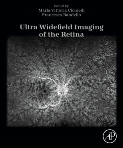 Ultra Widefield Imaging of the Retina