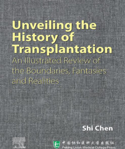 Unveiling the History of Transplantation - 1st Edition