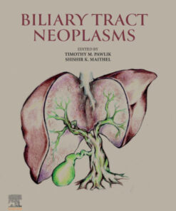 Biliary Tract Neoplasms