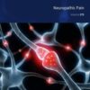 Neuropathic Pain - 1st Edition