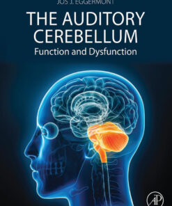The Auditory Cerebellum