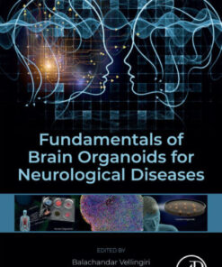Fundamentals of Brain Organoids for Neurological Diseases