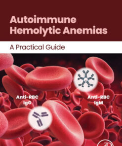 Autoimmune Hemolytic Anemias