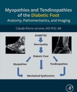 Myopathies and Tendinopathies of the Diabetic Foot - 1st Edition