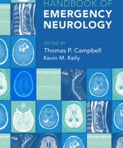 Handbook of Emergency Neurology