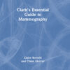 Clark's Essential Guide to Mammography - 1st Edition