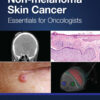 Non-melanoma Skin Cancer - 1st Edition
