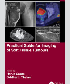 Practical Guide for Imaging of Soft Tissue Tumours - 1st Edition