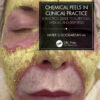 Chemical Peels in Clinical Practice - 1st Edition