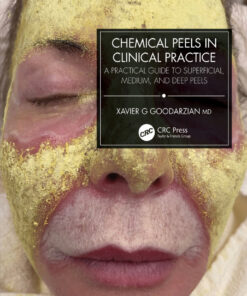 Chemical Peels in Clinical Practice - 1st Edition