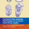 The Human Brain during the First Trimester 3.5- to 4.5-mm Crown-Rump Lengths - 1st Edition