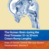 The Human Brain during the First Trimester 31- to 33-mm Crown-Rump Lengths - 1st Edition