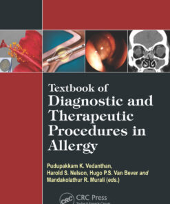 Textbook of Diagnostic and Therapeutic Procedures in Allergy - 1st Edition