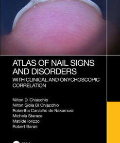 Atlas of Nail Signs and Disorders with Clinical and Onychoscopic Correlation - 1st Edition