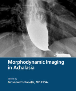 Morphodynamic Imaging in Achalasia - 1st Edition