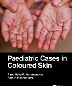 Paediatric Cases in Coloured Skin - 1st Edition
