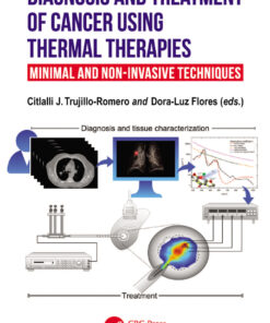Diagnosis and Treatment of Cancer using Thermal Therapies - 1st Edition