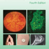 Atlas of Diabetes Mellitus - 4th Edition