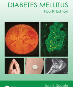 Atlas of Diabetes Mellitus - 4th Edition