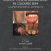 Atlas of Clinical Dermatology in Coloured Skin - 1st Edition