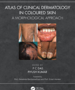 Atlas of Clinical Dermatology in Coloured Skin - 1st Edition