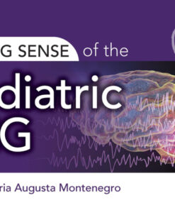 Making Sense of the Pediatric EEG - 1st Edition