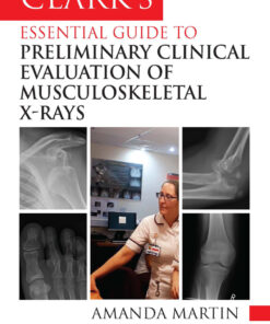 Clark’s Essential Guide to Preliminary Clinical Evaluation of Musculoskeletal X-rays - 1st Edition