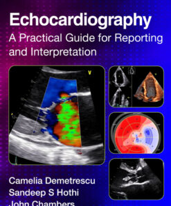 Echocardiography - 4th Edition
