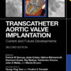 Transcatheter Aortic Valve Implantation - 2nd Edition