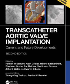 Transcatheter Aortic Valve Implantation - 2nd Edition