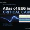 Hirsch and Brenner's Atlas of EEG in Critical Care - 2nd Edition