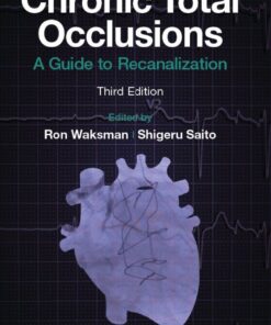 Chronic Total Occlusions - 3rd Edition