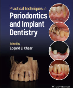 Practical Techniques in Periodontics and Implant Dentistry - 1st Edition