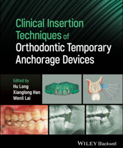 Clinical Insertion Techniques of Orthodontic Temporary Anchorage Devices - 1st Edition