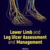 Lower Limb and Leg Ulcer Assessment and Management - 1st Edition