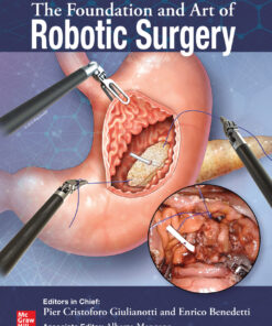 The Foundation and Art of Robotic Surgery - 1st Edition