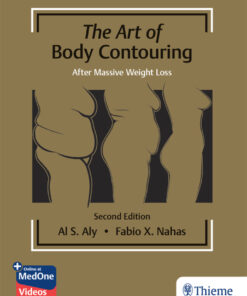 The Art of Body Contouring: After Massive Weight Loss - 2nd Edition