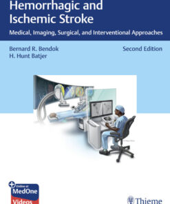 Hemorrhagic and Ischemic Stroke - 2nd Edition