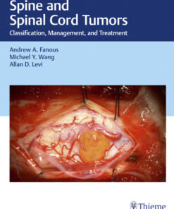 Spine and Spinal Cord Tumors - 1st Edition