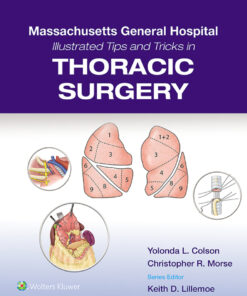 Massachusetts General Hospital Illustrated Tips and Tricks in Thoracic Surgery - 1st Edition