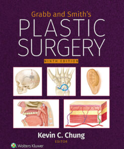 Grabb and Smith's Plastic Surgery - 9th Edition