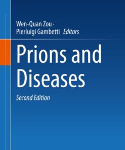 Prions and Diseases - 2nd Edition