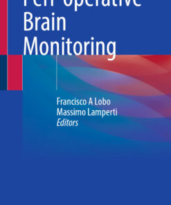 Peri-operative Brain Monitoring